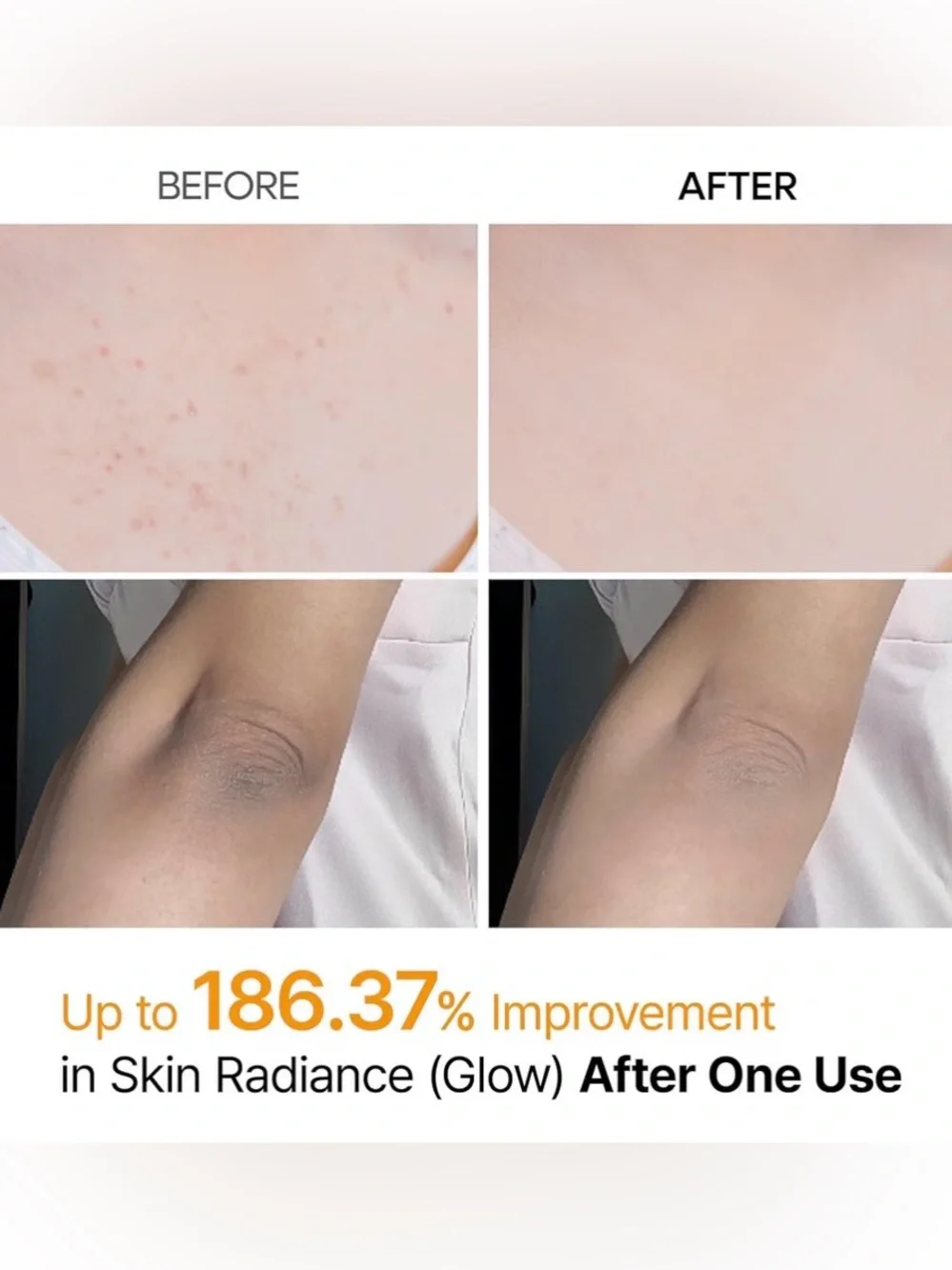 Dr. Melaxin Peel Shot Exfoliating Kojic Acid Turmeric Spray.  200ml  NEW